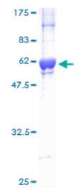 SDS-PAGE (CDK2-1000H).jpg